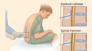 Neuro & Spine Surgery Expert
