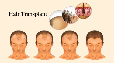 Best Cosmetic and Plastic Hospital in India