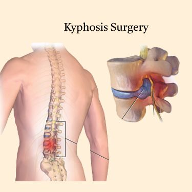 Neuro & Spine Surgery Expert