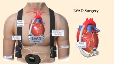 Heart & Vascular Surgery Consultant