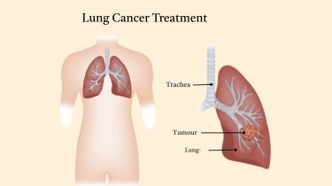 Cancer & Surgical Oncology Expert