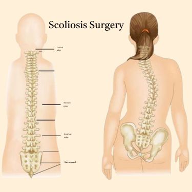 Neuro & Spine Surgery Expert