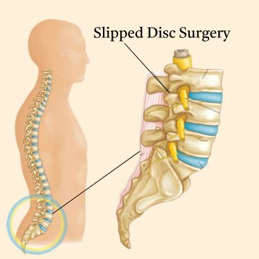 Spine Surgeon for Back Pain Treatment