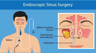 ENT specialists in India,