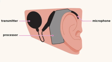 Best ent doctors India