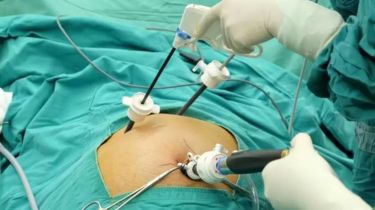 General & Laparoscopic Surgery Consultant