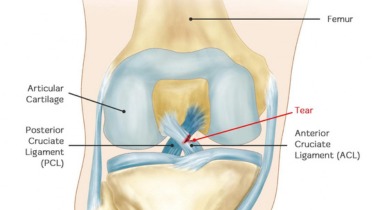 Orthopaedic & Joint Replacement Specialist in India , Expert Bone & Joint Care – Healthfly