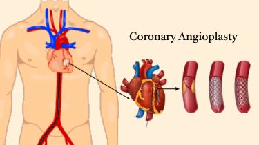 Top Cardiologist in India
